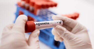 Laboratory testing of a microbiological water sample for real-time water quality monitoring