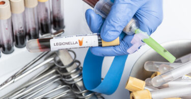 A scientist's hand holding a test tube containing a blood sample for a Legionella test.