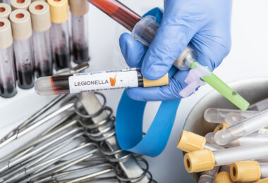 A scientist's hand holding a test tube containing a blood sample for a Legionella test.